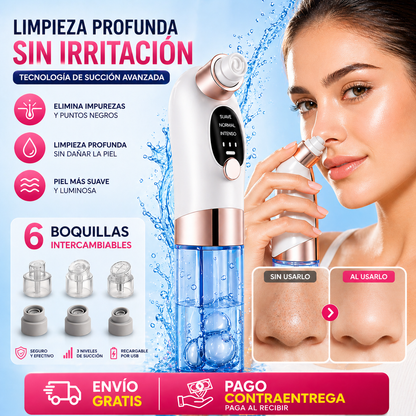✨ Removedor de Puntos Negros con Succión Profesional 💎